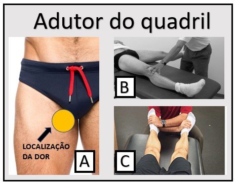 Distensão Muscular - Dr. João Hollanda