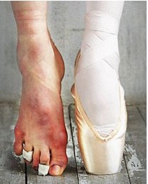 Anatomia do pé de bailarina  Pés de bailarina, Ballet, Anatomia do pé